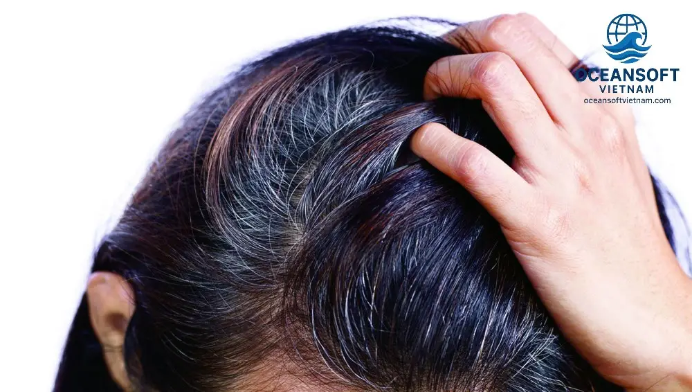 Thay đổi chế độ ăn uống và lối sống Thay đổi chế độ ăn uống và lối sống